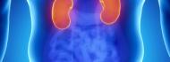 Kidney Cancer in Israel