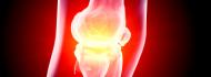 Knee replacement surgery in Israel