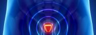 Prostate Cancer
