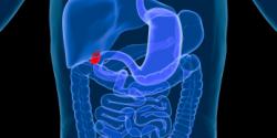 Gallbladder cancer treatment in Israel