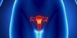 Cervical Cancer Treatment in Israel