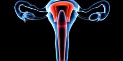 Ovarian Cancer Treatment in Israel