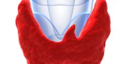 Thyroid Cancer Treatment in Israel