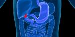 Gallbladder cancer treatment in Israel