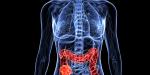 Colon Cancer Treatment in Israel
