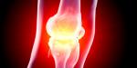 Knee replacement surgery in Israel
